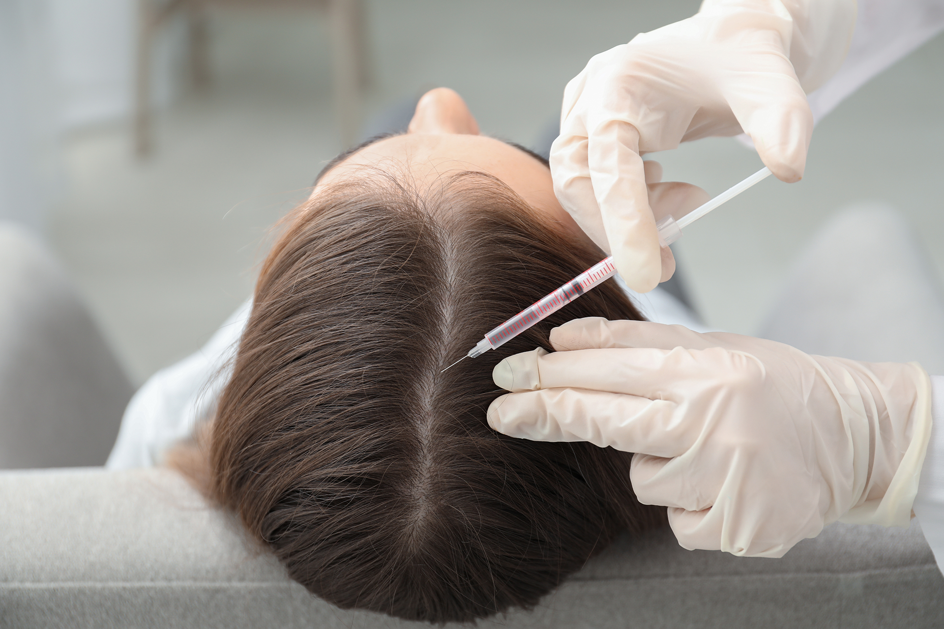 Mésotherapie cheveux à Cannes et Nice - Clinique Le Verdun