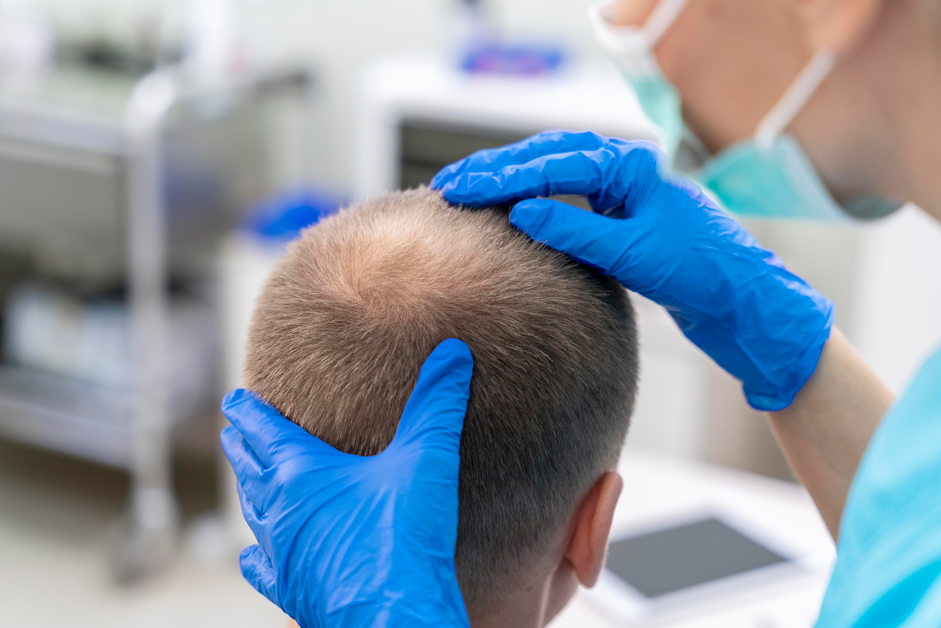 Consultation greffe cheveux à Cannes et Nice - Clinique Le Verdun